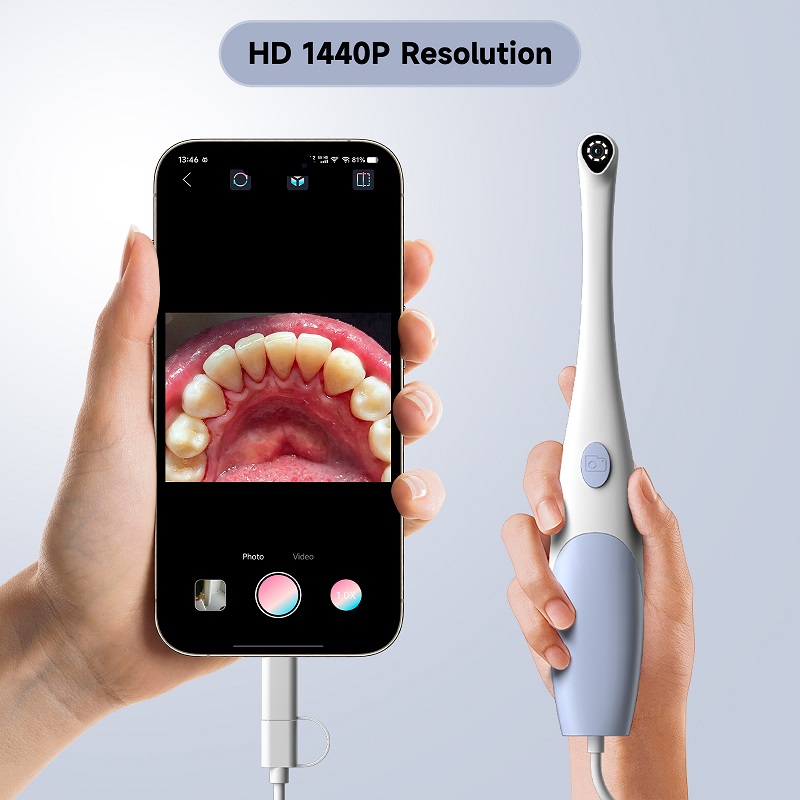 Telecamera Endoscopica Orale 1 - Macro Photography Led Lighting recensione e prezzo