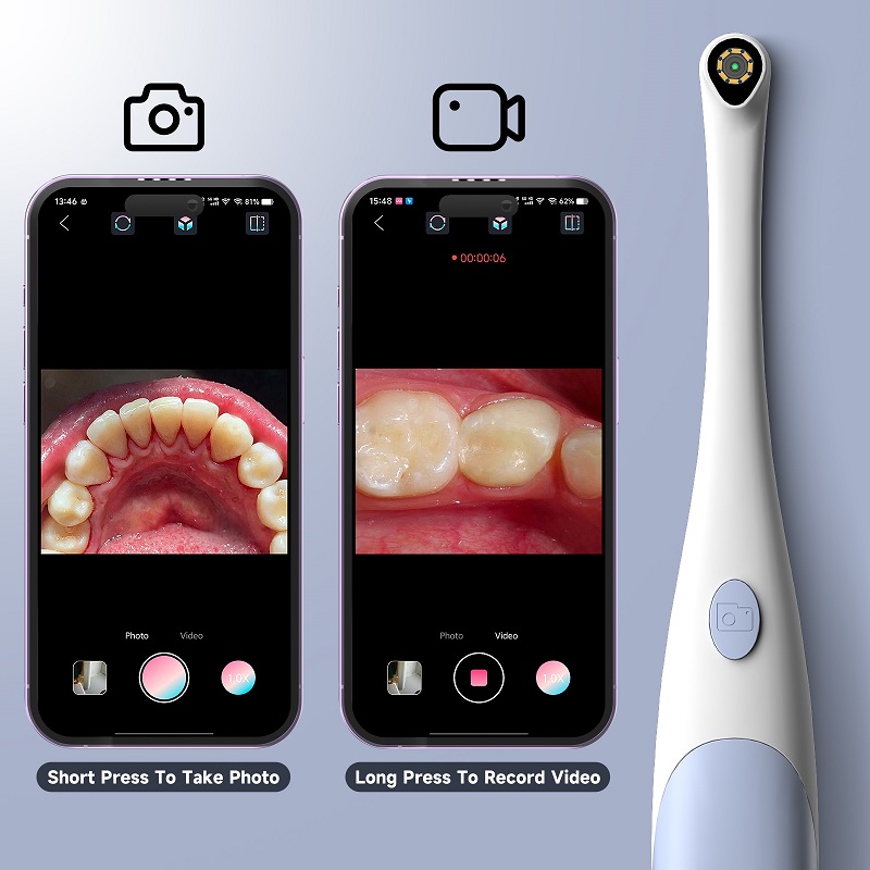 Telecamera Endoscopica Orale 1 - Macro Photography Led Lighting recensione e prezzo